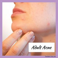 Adult acne - Transform-Lives.com
