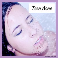Teen Acne - Transform-Lives.com